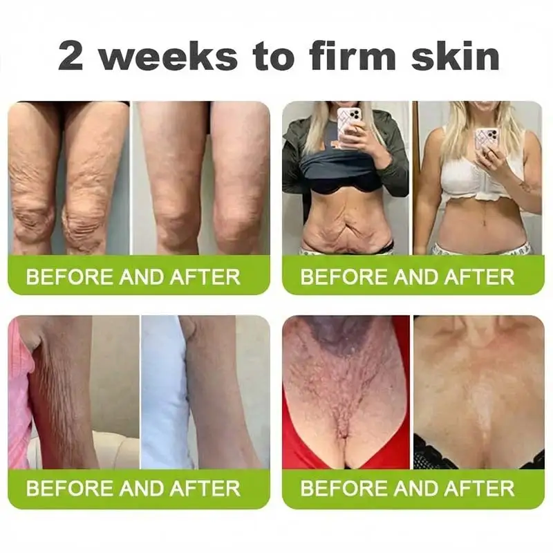 🧠👨⚕️Made and shipped from the USA 💫LOVILDS® moringa & Vita-A Retinol Shot Wrinkle-Lift Tightening cream - Last Day Promotion 50% OFF