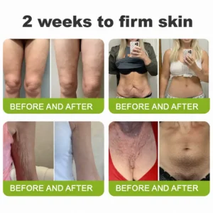 🧠👨‍⚕️Made and shipped from the USA 💫Lovilds® Botin & Vita-A Retinol Shot Wrinkle-Lift Tightening cream - Last Day Promotion 70% OFF