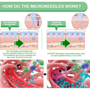 🇺🇸 𝑶𝒇𝒇𝒊𝒄𝒊𝒂𝒍 𝑺𝒕𝒐𝒓𝒆 💖 | 👩‍⚕️ 𝑳𝑶𝑽𝑰𝑳𝑫𝑺® 𝟏𝟐-𝑰𝑵-1 𝑴𝒐𝒓𝒊𝒏𝒈𝒂 * 𝑩𝒆𝒓𝒃𝒆𝒓𝒊𝒏𝒆 * 𝑵𝑨𝑫+ 𝑨𝒅𝒗𝒂𝒏𝒄𝒆𝒅 𝑵𝒂𝒏𝒐 𝑴𝒊𝒄𝒓𝒐𝒏𝒆𝒆𝒅𝒍𝒆 𝑷𝒂𝒕𝒄𝒉 (𝑶𝒏𝒄𝒆 𝑫𝒂𝒊𝒍𝒚, 𝒗𝒊𝒔𝒊𝒃𝒍𝒆 𝒄𝒉𝒂𝒏𝒈𝒆𝒔 𝒊𝒏 𝟕 𝒅𝒂𝒚𝒔) 𝑭𝒐𝒓 𝑶𝒃𝒆𝒔𝒊𝒕𝒚, 𝑳𝒐𝒐𝒔𝒆 𝑺𝒌𝒊𝒏, 𝑫𝒊𝒂𝒃𝒆𝒕𝒆𝒔, 𝑺𝒍𝒆𝒆𝒑 𝑨𝒑𝒏𝒆𝒂, 𝑨𝒏𝒅 𝑱𝒐𝒊𝒏𝒕 𝑰𝒔𝒔𝒖𝒆𝒔