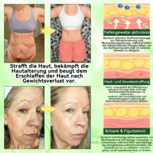 𝑶𝒇𝒇𝒊𝒄𝒊𝒂𝒍 𝑺𝒕𝒐𝒓𝒆  |🍁LOVILDS® 𝑴𝒐𝒓𝒊𝒏𝒈𝒂 𝒙 𝑩𝒆𝒓𝒃𝒆𝒓𝒊𝒏 10-𝑰𝑵-1 𝒇𝒐𝒓𝒕𝒈𝒆𝒔𝒄𝒉𝒓𝒊𝒕𝒕𝒆𝒏 𝑵𝒂𝒏𝒐 𝑴𝒊𝒌𝒓𝒐𝒏𝒂𝒅𝒆𝒍 𝑷𝒇𝒍𝒂𝒔𝒕𝒆𝒓 (𝑬𝒊𝒏𝒎𝒂𝒍 𝒕ä𝒈𝒍𝒊𝒄𝒉, 𝒔𝒊𝒄𝒉𝒕𝒃𝒂𝒓𝒆 𝑽𝒆𝒓ä𝒏𝒅𝒆𝒓𝒖𝒏𝒈𝒆𝒏 𝒊𝒏 7 𝑻𝒂𝒈𝒆𝒏）✅ 𝑨𝒅𝒊𝒑𝒐𝒔𝒊𝒕𝒂𝒔, 𝑫𝒊𝒂𝒃𝒆𝒕𝒆𝒔, 𝑺𝒄𝒉𝒍𝒂𝒇𝒂𝒑𝒏𝒐𝒆 𝒖𝒏𝒅 𝑮𝒆𝒍𝒆𝒏𝒌𝒑𝒓𝒐𝒃𝒍𝒆𝒎𝒆