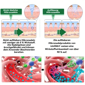 𝑶𝒇𝒇𝒊𝒄𝒊𝒂𝒍 𝑺𝒕𝒐𝒓𝒆  |🍁LOVILDS® 𝑴𝒐𝒓𝒊𝒏𝒈𝒂 𝒙 𝑩𝒆𝒓𝒃𝒆𝒓𝒊𝒏 10-𝑰𝑵-1 𝒇𝒐𝒓𝒕𝒈𝒆𝒔𝒄𝒉𝒓𝒊𝒕𝒕𝒆𝒏 𝑵𝒂𝒏𝒐 𝑴𝒊𝒌𝒓𝒐𝒏𝒂𝒅𝒆𝒍 𝑷𝒇𝒍𝒂𝒔𝒕𝒆𝒓 (𝑬𝒊𝒏𝒎𝒂𝒍 𝒕ä𝒈𝒍𝒊𝒄𝒉, 𝒔𝒊𝒄𝒉𝒕𝒃𝒂𝒓𝒆 𝑽𝒆𝒓ä𝒏𝒅𝒆𝒓𝒖𝒏𝒈𝒆𝒏 𝒊𝒏 7 𝑻𝒂𝒈𝒆𝒏）✅ 𝑨𝒅𝒊𝒑𝒐𝒔𝒊𝒕𝒂𝒔, 𝑫𝒊𝒂𝒃𝒆𝒕𝒆𝒔, 𝑺𝒄𝒉𝒍𝒂𝒇𝒂𝒑𝒏𝒐𝒆 𝒖𝒏𝒅 𝑮𝒆𝒍𝒆𝒏𝒌𝒑𝒓𝒐𝒃𝒍𝒆𝒎𝒆