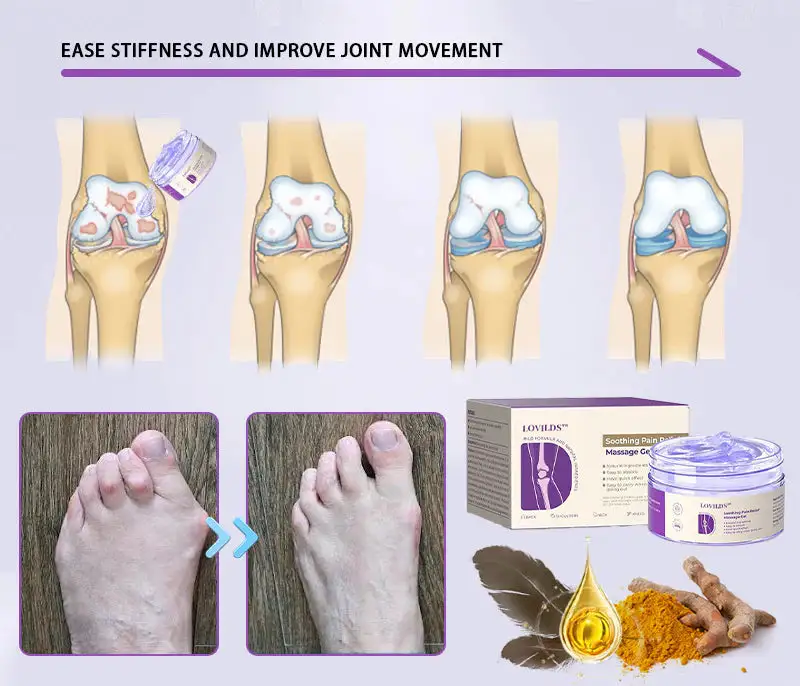 ✅ Official store: LOVILDS™ Turmeric & Emu Oil Arthritis Soothing Pain Relief Massage Gel(👨⚕️AAD Recommended)