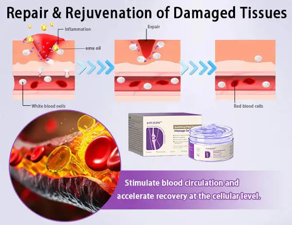 ✅ Official store: LOVILDS™ Turmeric & Emu Oil Arthritis Soothing Pain Relief Massage Gel(👨⚕️AAD Recommended)