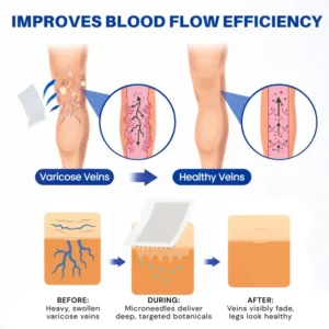 LOVILDS® 𝑽𝗲𝗶𝙣 𝘾𝐨𝐧𝘁𝗼𝙪𝙧 𝙈𝙞𝐜𝐫𝒐𝒏𝒆𝗲𝗱𝗹𝙚 𝙋𝙖𝐭𝐜𝒉 𝒘𝒊𝘁𝗵 𝗔𝙙𝙫𝙖𝙣𝙘𝐞𝐝 𝐃𝒊𝒐𝒔𝗺𝙞𝐧 & 𝑯𝒆𝘀𝗽𝗲𝙧𝙞𝙙𝙞𝐧 𝐃𝒆𝒍𝒊𝒗𝗲𝗿𝙮🌿𝟕-𝐃𝐚𝐲 𝐕𝐢𝐬𝐢𝐛𝐥𝐞 𝐑𝐞𝐬𝐮𝐥𝐭𝐬 𝐟𝐨𝐫 𝐕𝐚𝐫𝐢𝐜𝐨𝐬𝐞 𝐕𝐞𝐢𝐧𝐬