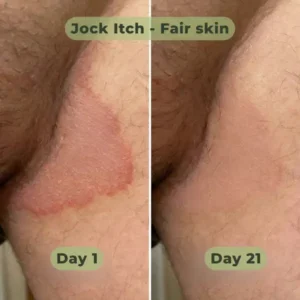 LOVILDS™ Antifungal Purifying Soap