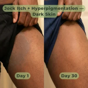 LOVILDS™ Antifungal Purifying Soap