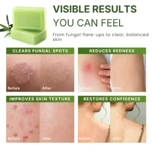 LOVILDS™ Antifungal Purifying Soap