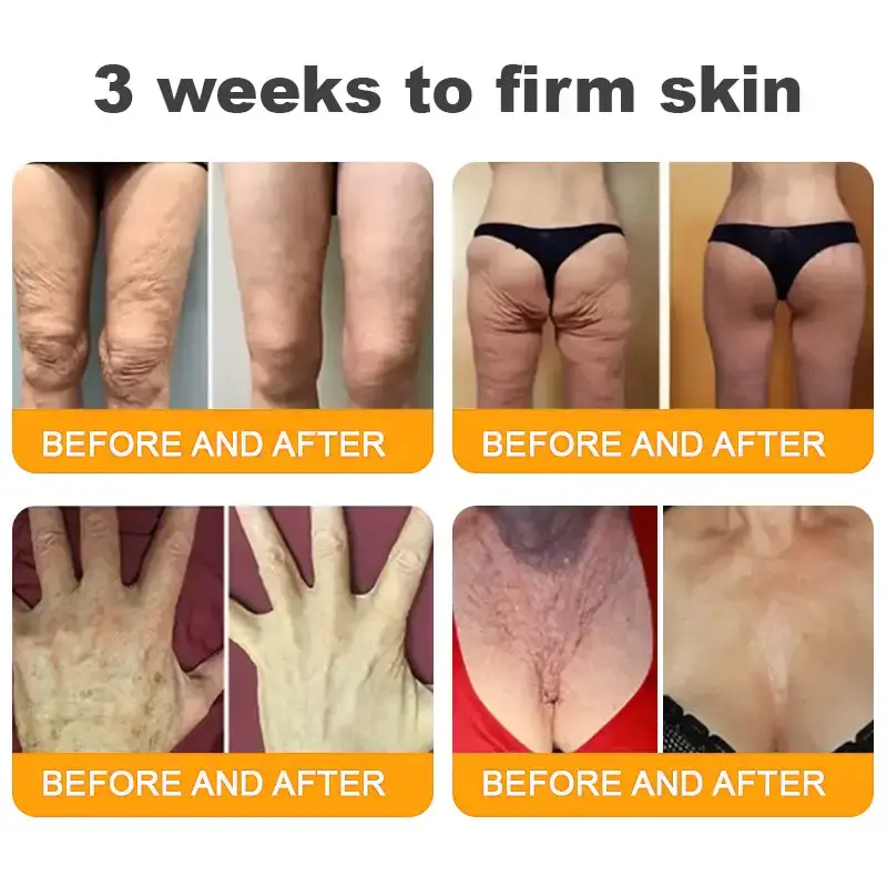 LOVILDS™ Bee Poison Skin Restoration Cream | Professional Repair Formula