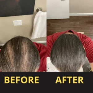 LOVILDS Hair Concealer 50ML - Waterproof 3–7 days.