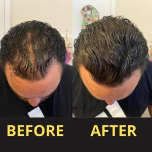 LOVILDS Hair Concealer 50ML - Waterproof 3–7 days.