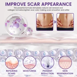 LOVILDS™ ReGenScar Stem Cell Repair Gel (Visible Scar Improvement in 7 Days)