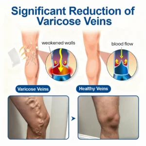 🇺🇸👨‍⚕️LOVILDS™ VeinEase Microneedle Care Patch⚡Instant Relief, Long-Term Results