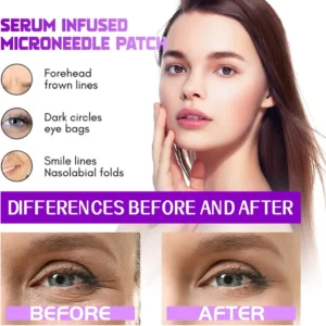 LOVILDS microneedle patch