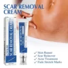 🔥Limited-time 60% sale--LOVILDS Scar Repair Cream — Smooth, Clear, Confident Skin