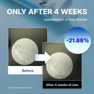 🔥Limited-time 60% sale--LOVILDS™  Ultimate Moisturizing Cream