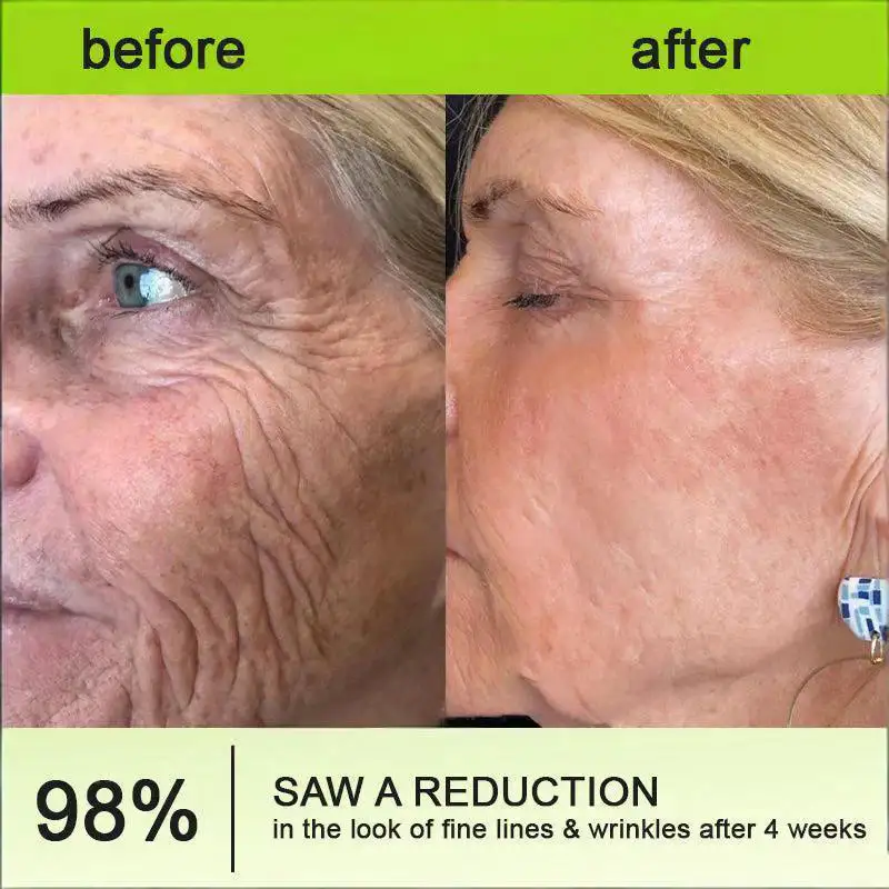 💫Lovilds® Botin & Vita-A Retinol Shot Wrinkle-Lift Tightening Cream - Last Day Promotion 70% OFF