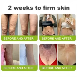 👨‍⚕️Made and shipped from the USA 💫LOVILDS® moringa & Vita-A Retinol Shot Wrinkle-Lift Tightening cream -Last Day Promotion 70% OFF