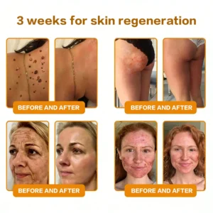 ✨Recommended by USA Skincare Research Center · Official LOVILDS® Store✨ ✨ Bee Poison Skin Renewal Cream✨