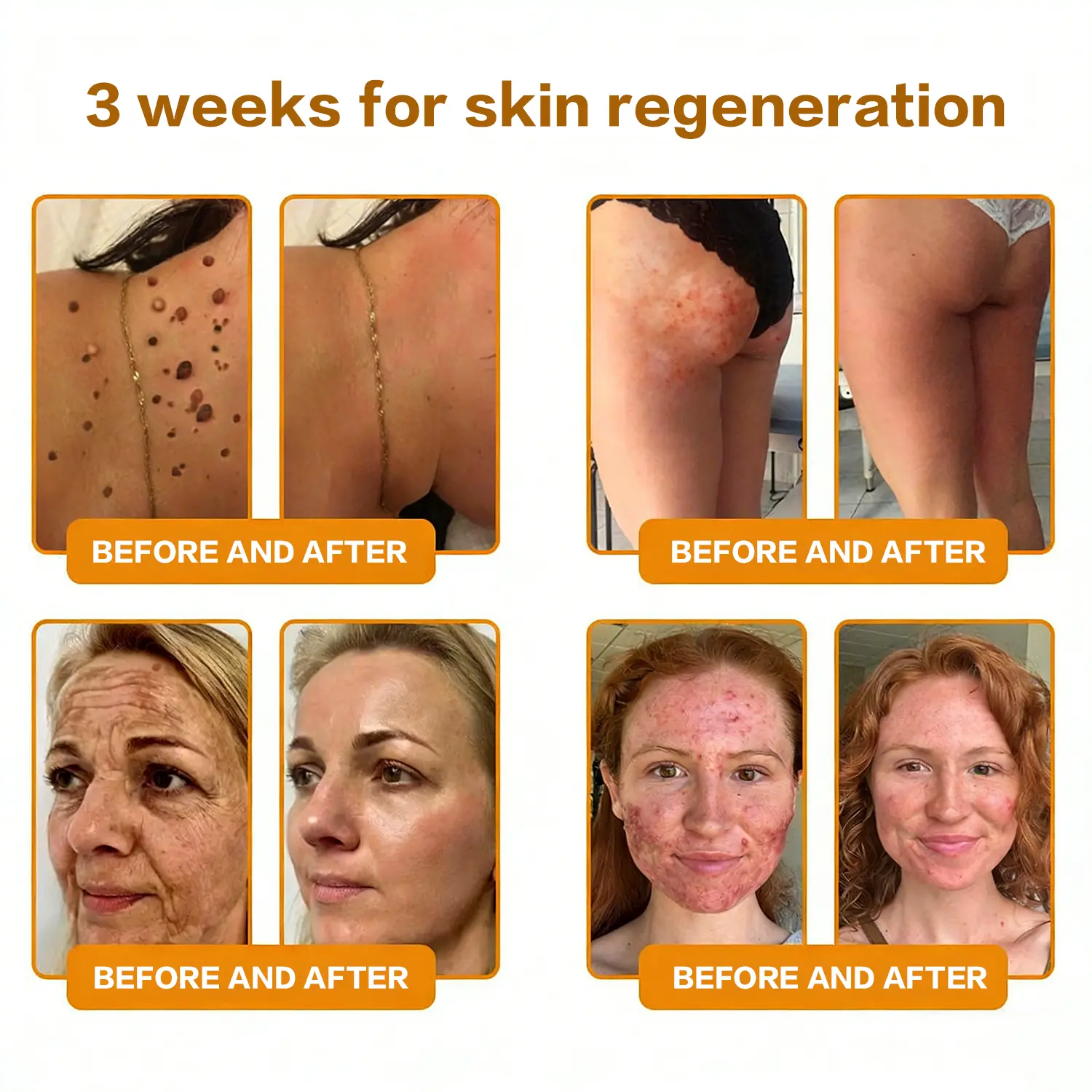 ✨Recommended by USA Skincare Research Center · Official LOVILDS® Store✨ ✨ Bee Poison Skin Renewal Cream✨