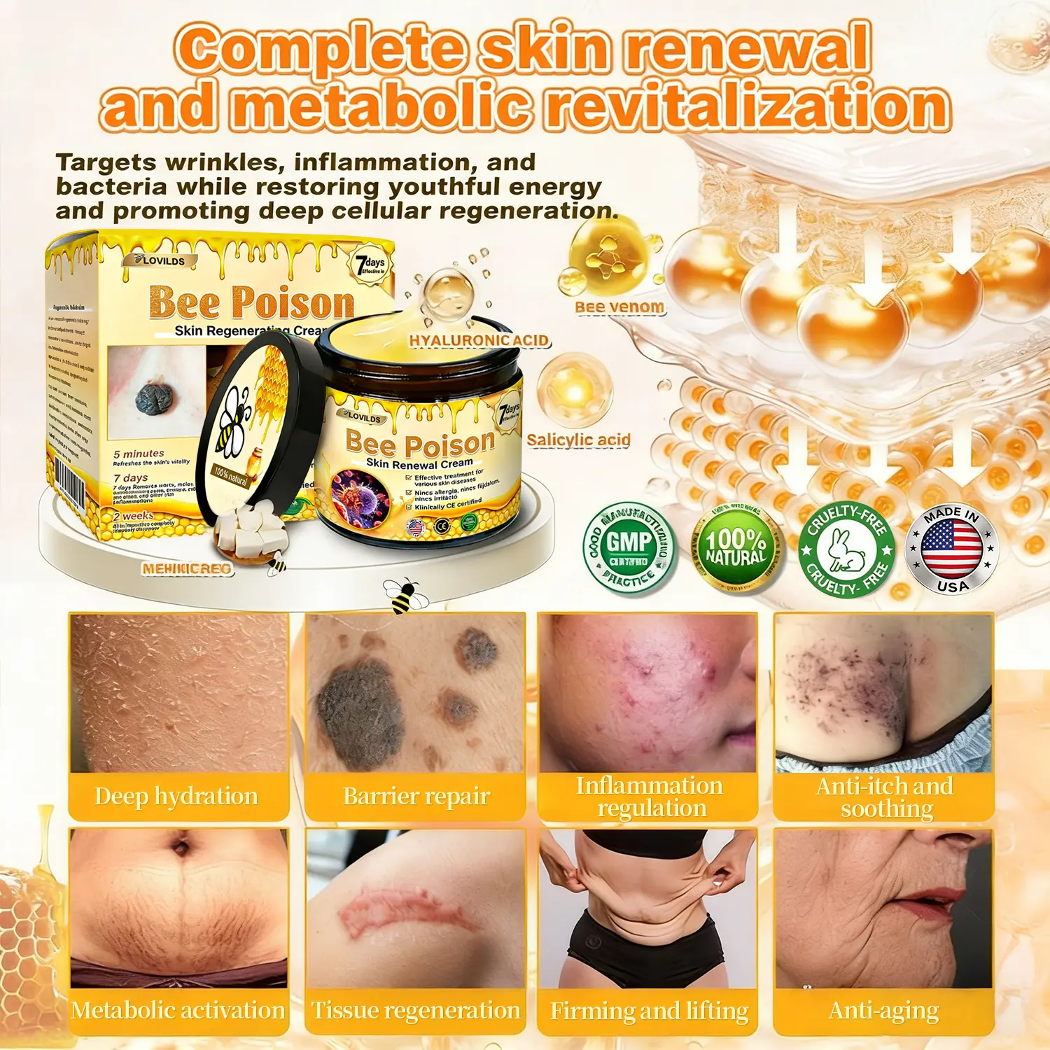 ✨Recommended by USA Skincare Research Center · Official LOVILDS® Store✨ ✨ Bee Poison Skin Renewal Cream✨