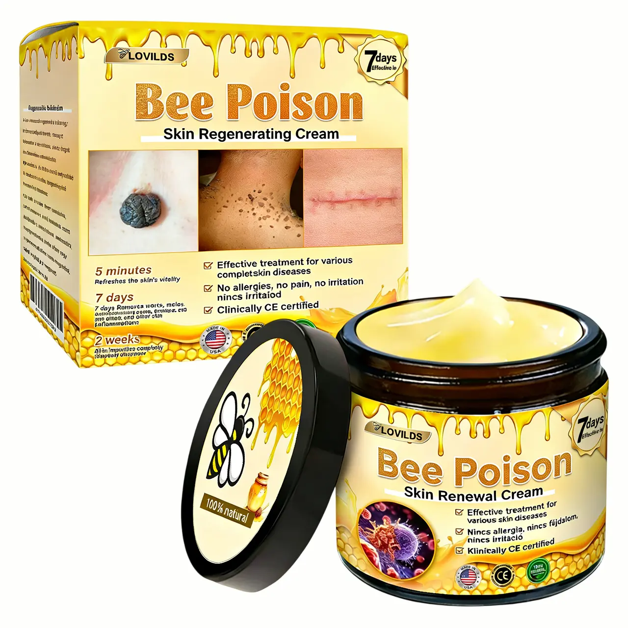 ✨Recommended by USA Skincare Research Center · Official LOVILDS® Store✨ ✨ Bee Poison Skin Renewal Cream✨
