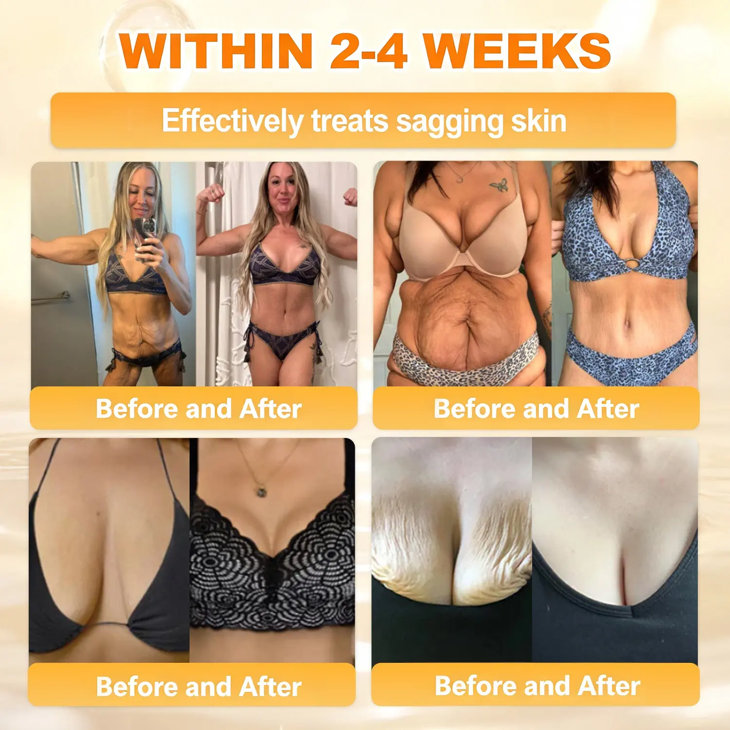 ✨Recommended by USA Skincare Research Center · Official LOVILDS® Store✨ ✨ Bee Poison Skin Renewal Cream✨