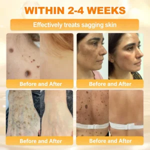 ✨Recommended by USA Skincare Research Center · Official LOVILDS® Store✨ ✨ Bee Poison Skin Renewal Cream✨