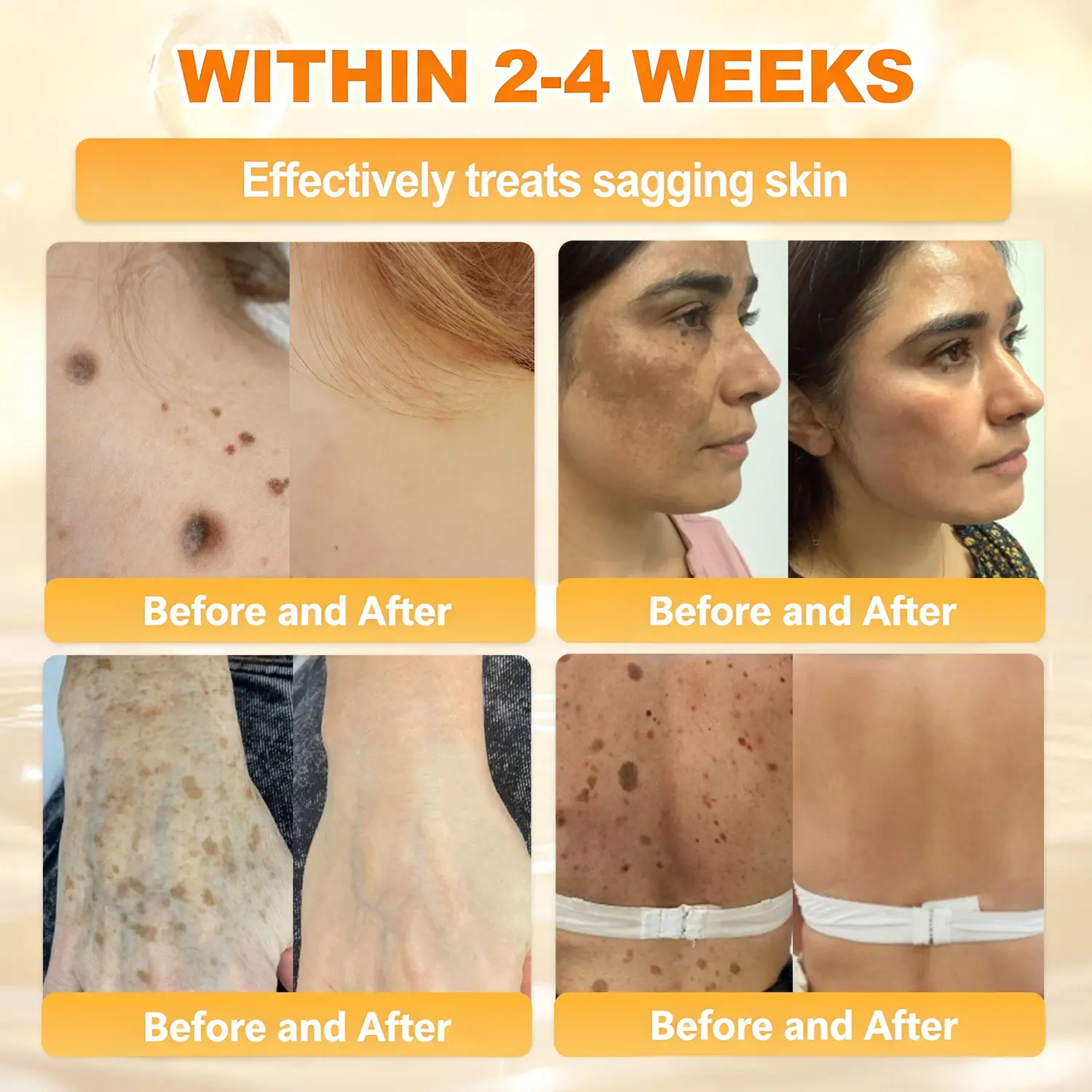 ✨Recommended by USA Skincare Research Center · Official LOVILDS® Store✨ ✨ Bee Poison Skin Renewal Cream✨