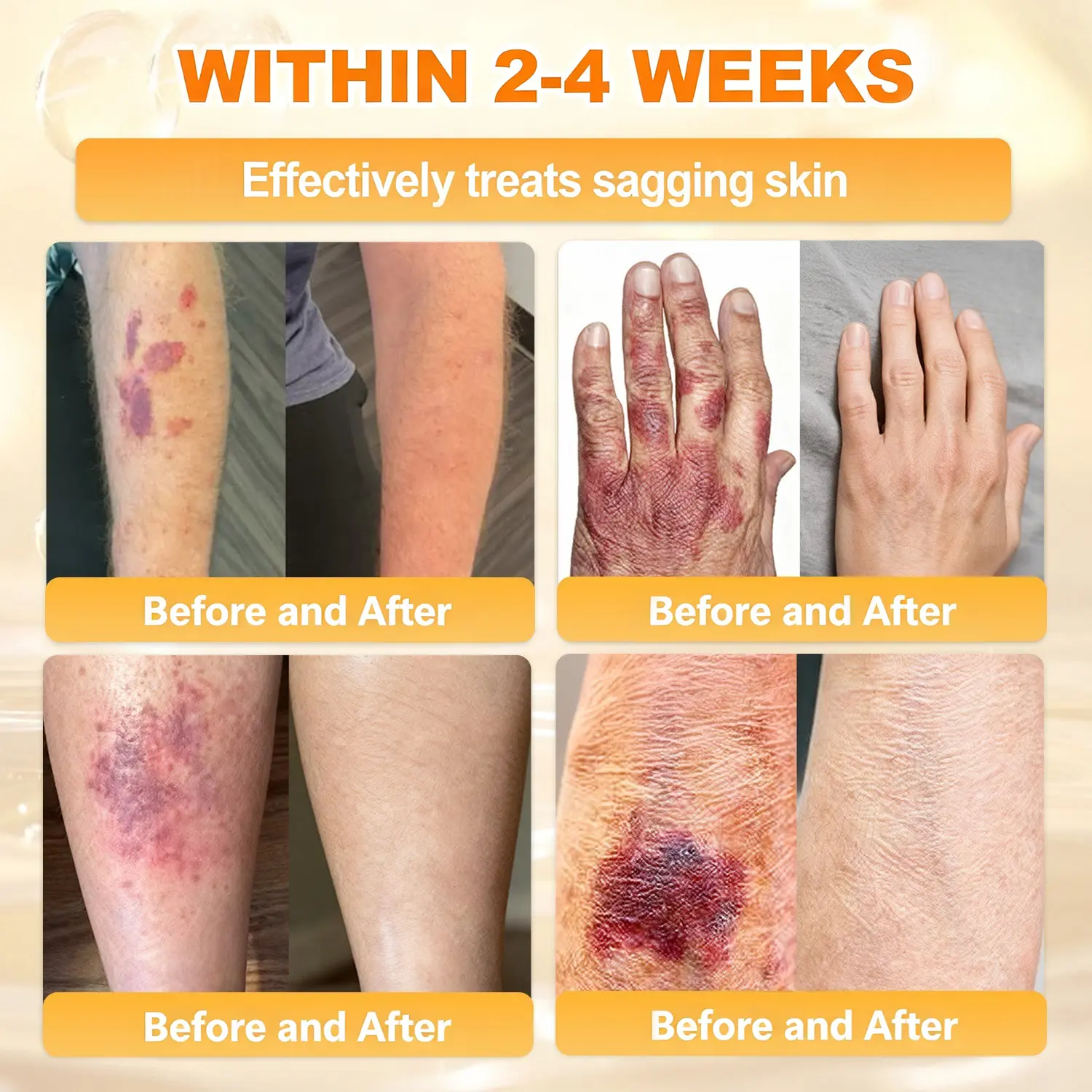 ✨Recommended by USA Skincare Research Center · Official LOVILDS® Store✨ ✨ Bee Poison Skin Renewal Cream✨