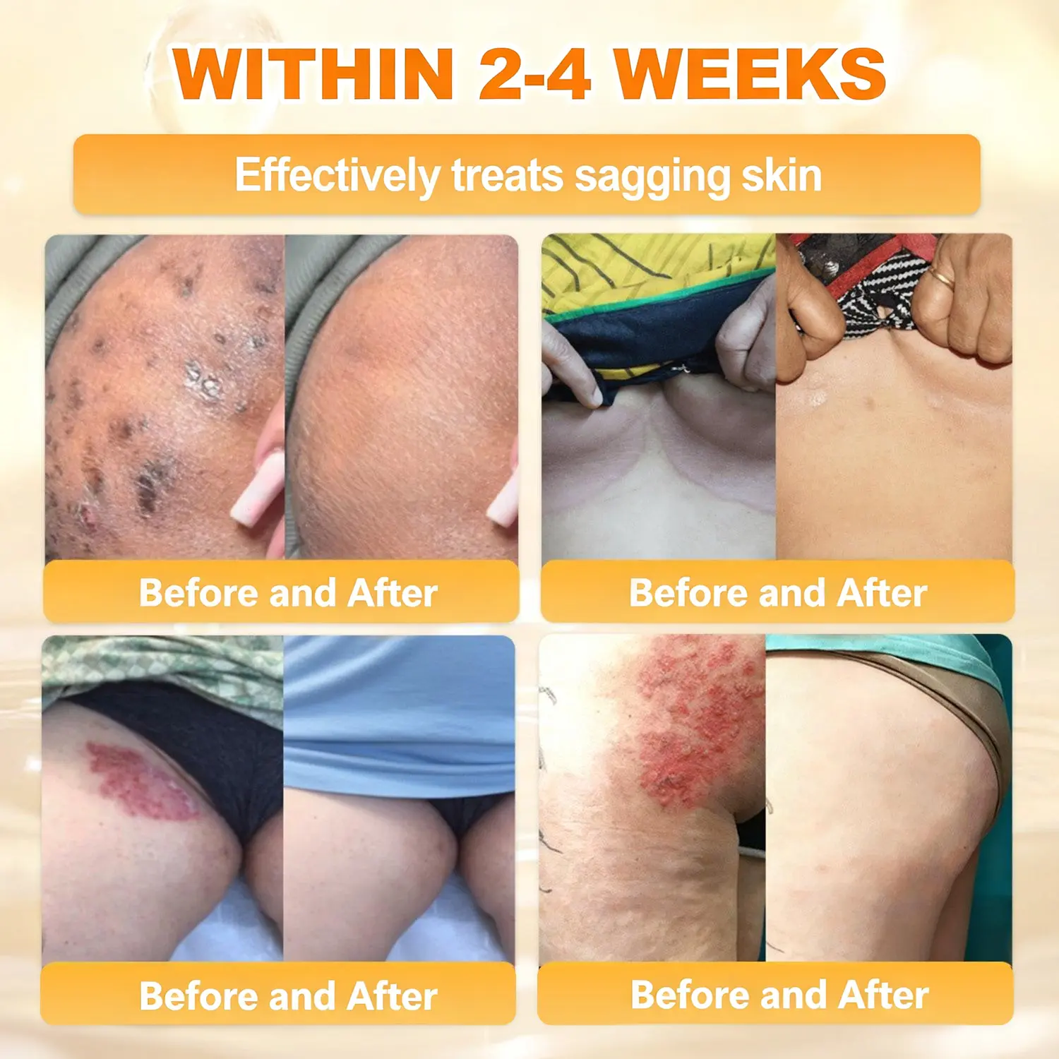 ✨Recommended by USA Skincare Research Center · Official LOVILDS® Store✨ ✨ Bee Poison Skin Renewal Cream✨