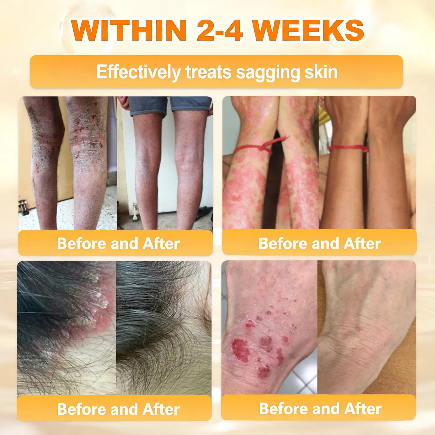 ✨Recommended by USA Skincare Research Center · Official LOVILDS® Store✨ ✨ Bee Poison Skin Renewal Cream✨