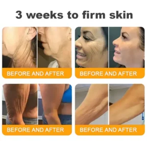 USA’s #1 LOVILDS™ Bee Venom Skin Restoration Cream — Smooth, Heal & Revitalize Your Skin