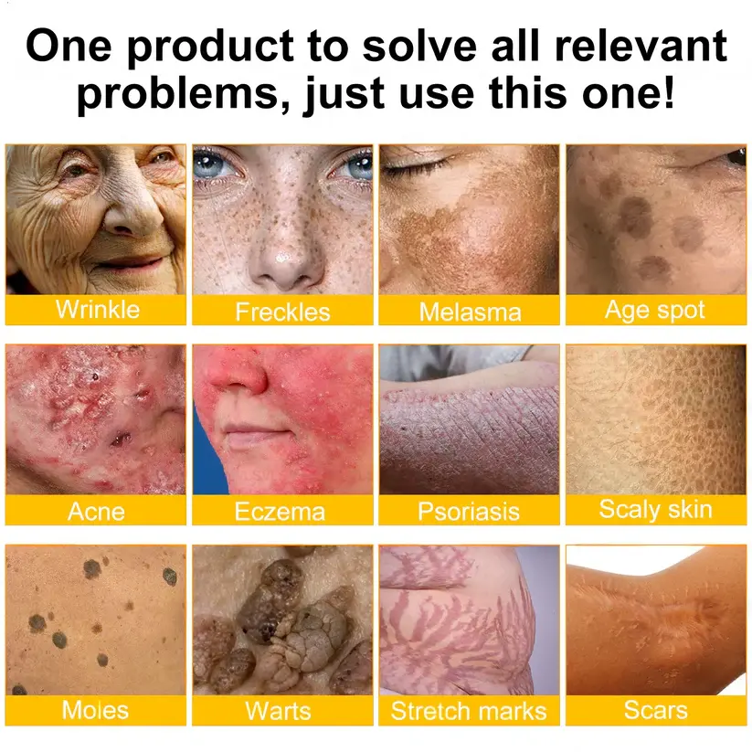 USA’s #1 LOVILDS™ Bee Venom Skin Restoration Cream — Smooth, Heal & Revitalize Your Skin