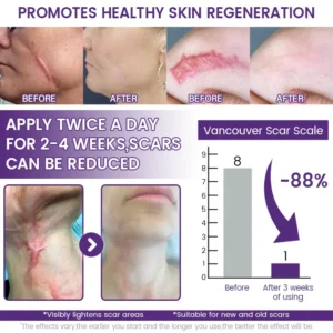 LOVILDS™ ReGenScar Stem Cell Repair Gel (Visible Scar Improvement in 7 Days)