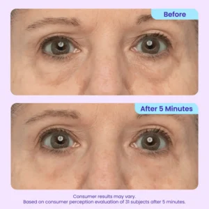 LOVILDS Instant Lift Eye Gel – For Eye Bags, Puffiness, Wrinkles, Fine Lines & Dark Circles🌱