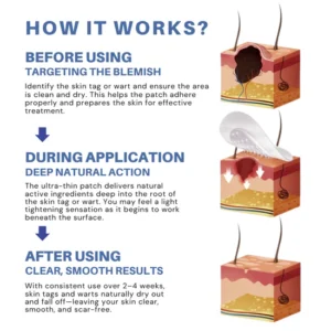Alternative view of LOVILDS® Moles & Warts Removing Skin Tag Patch