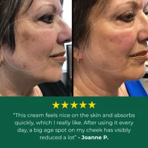 Lovilds Age Spot Cream