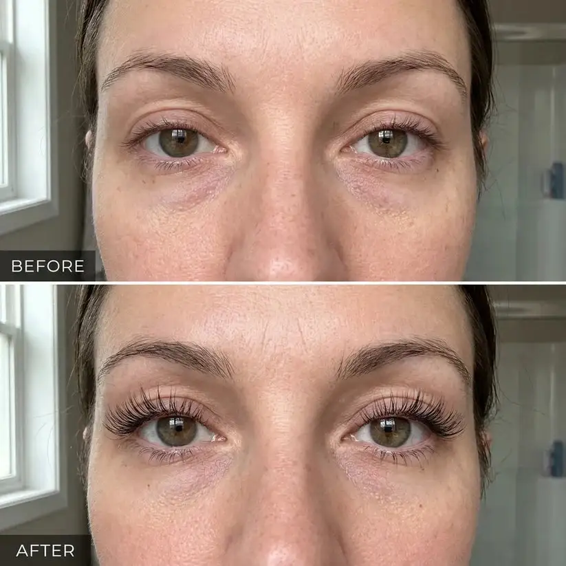 Lovilds Eyelash Growth Nourishing Serum - Non-Prostaglandin -
15ml / 0.5 fl.oz Jumbo