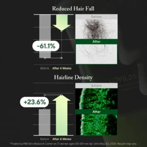 🌿 LOVILDS PDRN Scalp Serum | Root-Focused Care for Fuller, Healthier-Looking Hair ✨