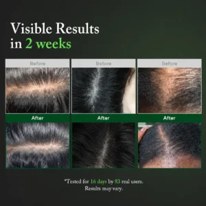 🌿 LOVILDS PDRN Scalp Serum | Root-Focused Care for Fuller, Healthier-Looking Hair ✨