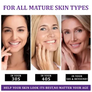 Lovilds Epiglow Melanev Advanced Anti Pigmentation Cream