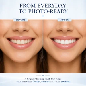 LOVILDS Tooth Polish - Instant White Smile