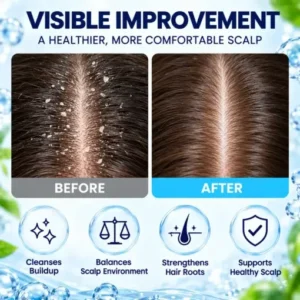 LOVILDS Scalp Soothing Cream