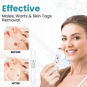 🔥【OFFICIAL STORE】LOVILDS™ Non-Invasive Mole and Wart Removal Laser Pen